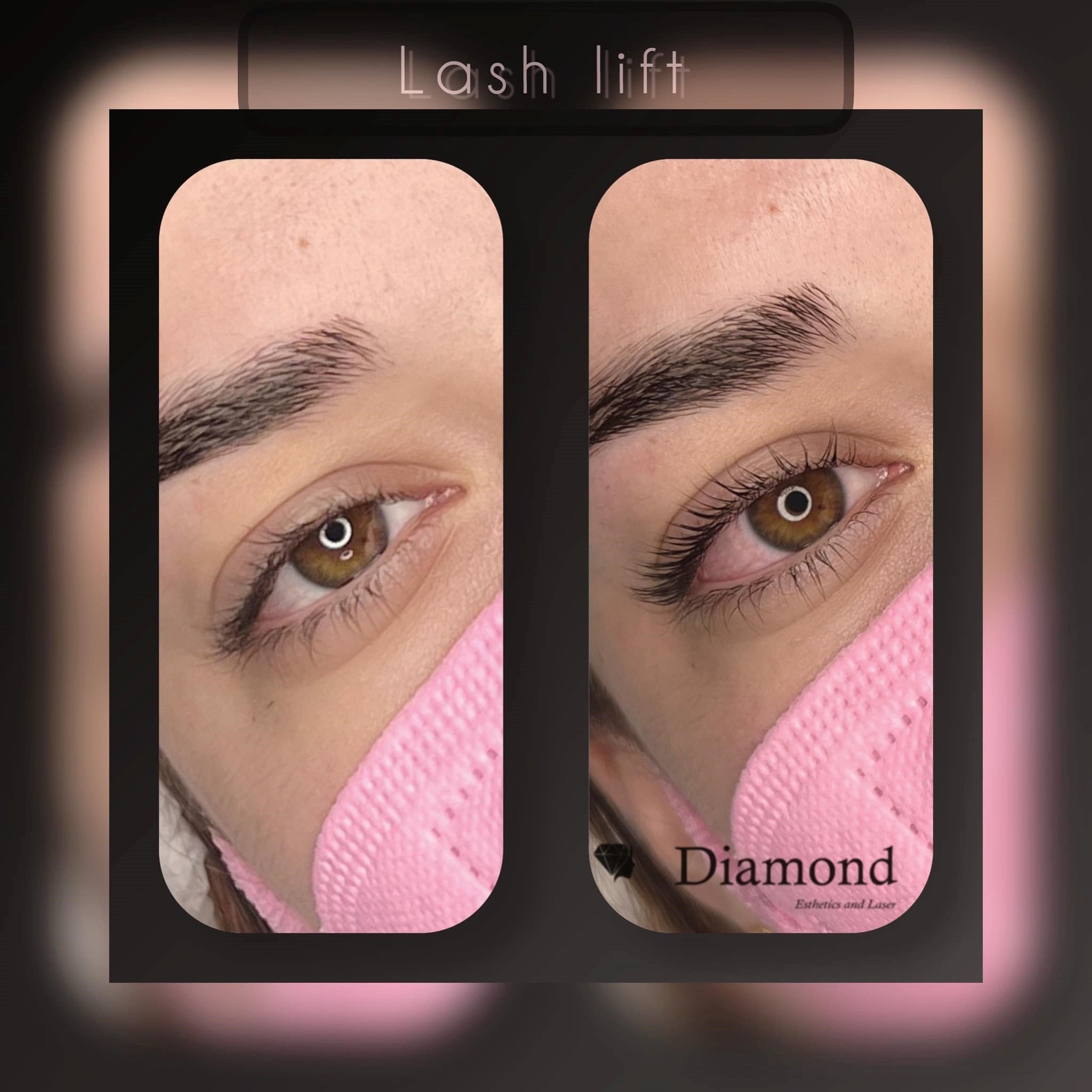 diamond-esthetics-and-laser9.jpg