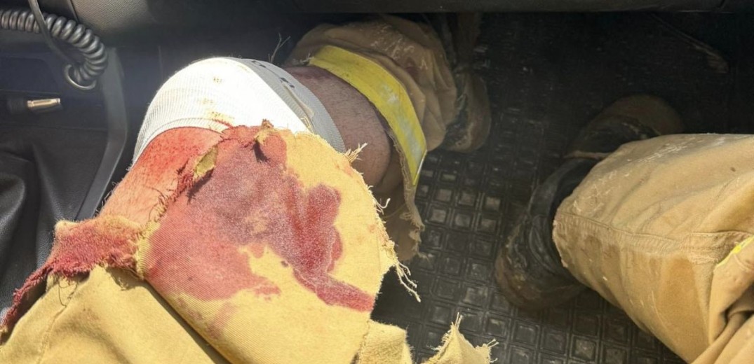 Τραυματίστηκε εθελοντής πυροσβέστης την ώρα της μάχης με την πυρκαγιά στα Πιέρια Όρη (βίντεο, φωτ.)
