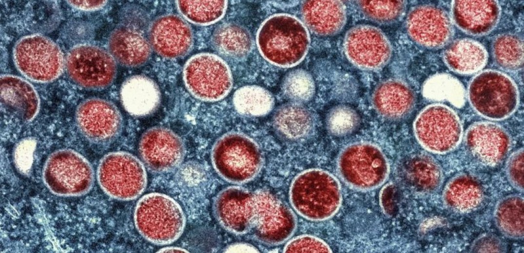 Ταϊλάνδη: Εντοπίστηκε κρούσμα της mpox - Ευρωπαίος ο ασθενής